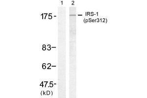 Western blot analysis of extract from 293 cells, using IRS-1 (Phospho-Ser312) antibody (E011143, Lane 1 and 2). (IRS1 antibody  (pSer312))