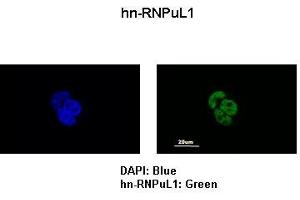 Sample Type :  MCF7 cells   Primary Antibody Dilution :   1:200   Secondary Antibody:  Anti-rabbit-FITC   Secondary Antibody Dilution:   1:500   Color/Signal Descriptions:  DAPI: Blue HNRNPUL1: Green   Gene Name:  HNRPUL1   Submitted by:  Anonymous (HNRNPUL1 antibody  (C-Term))