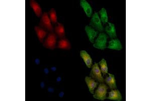 ABIN6257799 and ABIN6274834 staining  cells by IF/ICC. (AASS antibody  (C-Term))
