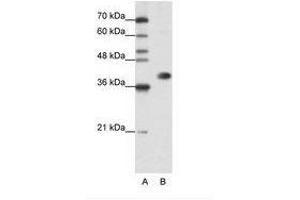 Image no. 3 for anti-Heterogeneous Nuclear Ribonucleoprotein A3 (HNRNPA3) (N-Term) antibody (ABIN202382) (HNRNPA3 antibody  (N-Term))