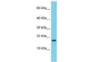Host: Rabbit Target Name: CCDC12 Sample Type: 721_B Whole Cell lysates Antibody Dilution: 1. (CCDC12 antibody  (C-Term))
