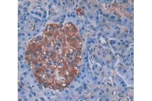 Used in DAB staining on fromalin fixed paraffin- embedded Kidney tissue (SRPRB antibody  (AA 58-271))
