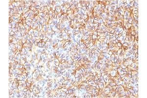 Formalin-fixed, paraffin-embedded human Pancreas stained with Spectrin beta III Monoclonal Antibody (SPTBN2/1584). (Spectrin, Beta, Non-erythrocytic 2 (SPTBN2) (AA 356-475) antibody)