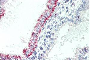 Immunohistochemistry (IHC) image for anti-Cholecystokinin B Receptor (CCKBR) (Internal Region) antibody (ABIN185407)