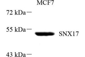 Western blot analysis of SNX17 (ABIN7075691),at dilution of 1: 800 (SNX17 antibody)