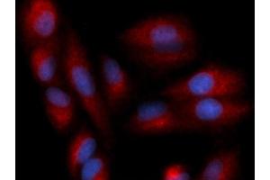 Immunofluorescence (IF) image for anti-Chemokine (C-C Motif) Ligand 22 (CCL22) (AA 25-93) antibody (PE) (ABIN5566347)