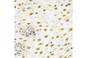 Immunohistochemistry (IHC) image for anti-Runt-Related Transcription Factor 1 (RUNX1) (AA 150-250) antibody (ABIN3022804)