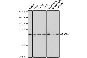 Western blot analysis of extracts of various cell lines, using RAB2A antibody. (RAB2A antibody)