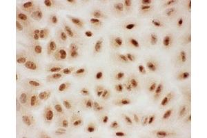 Immunocytochemistry (ICC) image for anti-Protein Inhibitor of Activated STAT, 1 (PIAS1) (AA 636-651) antibody (ABIN3032369)