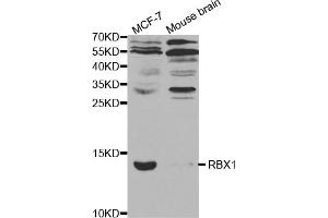 Western blot analysis of extracts of various cell lines, using RBX1 antibody. (RBX1 antibody)