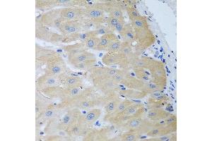 Immunohistochemistry of paraffin-embedded human liver using NME4 antibody at dilution of 1:100 (40x lens). (NME4 antibody)
