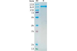 Human PSMA Protein, mFc Tag on SDS-PAGE under reducing condition. (PSMA Protein (mFc Tag))