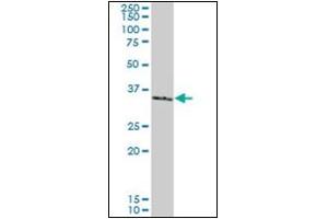 Western Blotting (WB) image for anti-SMAD, Mothers Against DPP Homolog 3 (SMAD3) antibody (ABIN781908) (SMAD3 antibody)