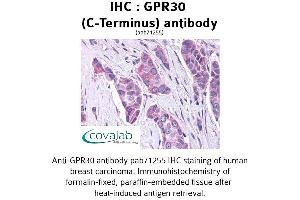 Image no. 1 for anti-G Protein-Coupled Estrogen Receptor 1 (GPER) (C-Term) antibody (ABIN1735053) (GPER antibody  (C-Term))