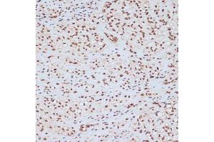 Immunohistochemistry (IHC) image for anti-Mitogen-Activated Protein Kinase 3 (MAPK3) (pTyr204) antibody (ABIN3019890)