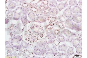 Formalin-fixed and paraffin embedded rat kidney tissue labeled with Anti-Phospho-5-Lipoxygenase(Ser663) Polyclonal Antibody, Unconjugated (ABIN743543) at 1:200 followed by conjugation to the secondary antibody and DAB staining (ALOX5 antibody  (pSer663))