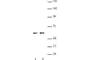 CDK8 antibody (pAb) tested by Western blot. (CDK8 antibody  (C-Term))