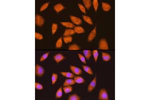 Immunofluorescence analysis of L929 cells using LY6E Rabbit pAb (ABIN6131998, ABIN6143391, ABIN6143392 and ABIN6214390) at dilution of 1:100 (40x lens). (LY6E antibody  (AA 21-101))