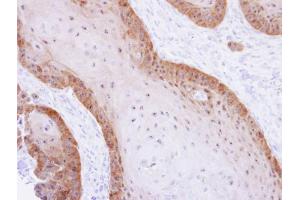 IHC-P Image Immunohistochemical analysis of paraffin-embedded Cal27 xenograft, using XBP1, antibody at 1:500 dilution.