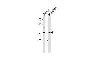 PK14 Antibody  (ABIN391332 and ABIN2841360) western blot analysis in Jurkat cell line and mouse kidney tissue lysates (35 μg/lane). (MAPK14 antibody  (AA 301-330))