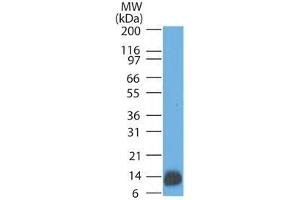 Western Blot Analysis of human brain lysate using S100B Mouse Monoclonal Antibody (4C4.