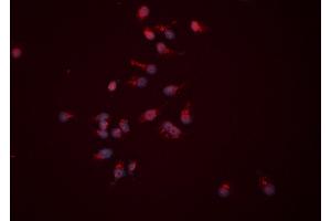 ABIN6276522 staining HEPG2 cells by ICC/IF. (APEX1 antibody  (N-Term))