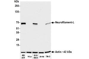 Western Blotting (WB) image for anti-Neurofilament, Light Polypeptide (NEFL) (AA 150-200) antibody (ABIN7453980)