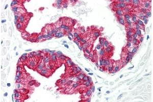 Human Prostate (formalin-fixed, paraffin-embedded) stained with KRT8 antibody ABIN292229 at 20 ug/ml followed by biotinylated anti-mouse IgG secondary antibody ABIN481714, alkaline phosphatase-streptavidin and chromogen. (KRT8 antibody)