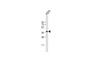 Anti-PIH1D1 Antibody (Center) at 1:1000 dilution +  whole cell lysate Lysates/proteins at 20 μg per lane. (PIH1D1 antibody  (AA 163-192))