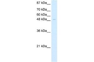 WB Suggested Anti-ZNF70 Antibody Titration:  5.