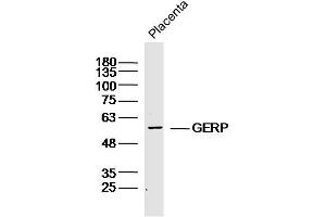 Mouse placenta lysates probed with GERP Polyclonal Antibody, Unconjugated  at 1:300 dilution and 4˚C overnight incubation. (TRIM8 antibody)
