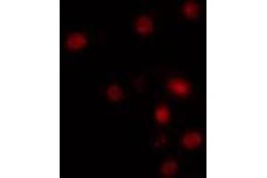 ABIN6274283 staining HuvEc cells by IF/ICC. (RBM5 antibody  (N-Term))
