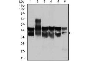 Western blot analysis using CDK2 mouse mAb against Jurkat (1), HL-60 (2), K562(3), A431(4), HeLa(5), and NIH3T3 (6) cell lysate. (CDK2 antibody)
