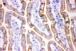 Anti- gamma Catenin Picoband antibody, IHC(F) IHC(F): Rat Intestine Tissue (JUP antibody  (AA 556-745))