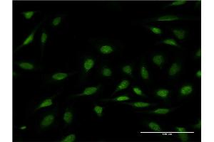 Immunofluorescence of monoclonal antibody to ZNF256 on HeLa cell. (ZNF256 antibody  (AA 521-627))