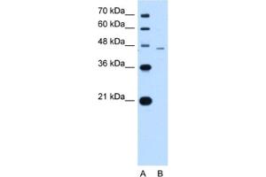 Western Blotting (WB) image for anti-SMAD, Mothers Against DPP Homolog 7 (SMAD7) antibody (ABIN2460354) (SMAD7 antibody)