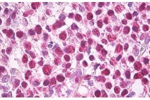 Anti-MCM5 antibody IHC staining of human tonsil.