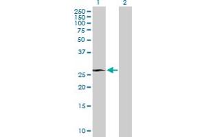 Western Blot analysis of RHOXF1 expression in transfected 293T cell line by RHOXF1 MaxPab polyclonal antibody. (RHOXF1 antibody  (AA 1-184))