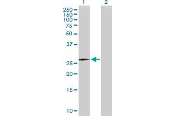 RHOXF1 antibody  (AA 1-184)