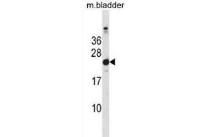 Mouse Hras1 Antibody (C-term) (ABIN1881438 and ABIN2838652) western blot analysis in mouse bladder tissue lysates (35 μg/lane). (HRAS antibody  (C-Term))