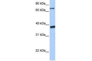 DIDO1 antibody used at 2. (DIDO1 antibody  (C-Term))