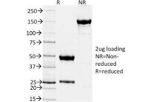 SDS-PAGE Analysis Purified TIMP2 Mouse Monoclonal Antibody (TIMP2/2044). (TIMP2 antibody  (AA 48-220))