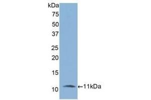 Detection of Recombinant IL6R, Rat using Polyclonal Antibody to Interleukin 6 Receptor (IL6R) (IL-6 Receptor antibody)