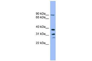 LHPP antibody used at 1 ug/ml to detect target protein. (LHPP antibody  (Middle Region))