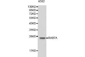 Western blot analysis of K562 cell lysate using RAB7A antibody. (RAB7A antibody  (C-Term))