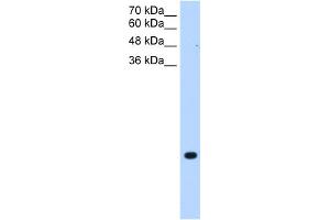 WB Suggested Anti-TMEM75 Antibody Titration:  0.