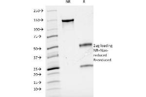 SDS-PAGE Analysis Purified Cyclin A Mouse Monoclonal Antibody (CCNA2/2333).