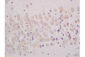Formalin-fixed and paraffin embedded rat brain labeled with Anti-phospho-Ephrin B (Tyr324 + Tyr29) Polyclonal Antibody, Unconjugated (ABIN684553) at 1:200 followed by conjugation to the secondary antibody and DAB staining (Ephrin B antibody  (pTyr324, pTyr329))