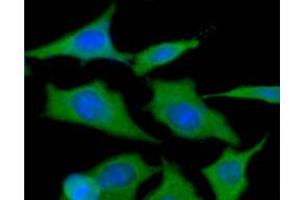 ICC/IF analysis of HSP90 in HeLa cells line, stained with DAPI (Blue) for nucleus staining and monoclonal anti-human HSP90 antibody (1:100) with goat anti-mouse IgG-Alexa fluor 488 conjugate (Green). (HSP90 antibody)