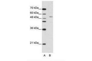 Image no. 1 for anti-G-Rich RNA Sequence Binding Factor 1 (GRSF1) (AA 21-80) antibody (ABIN202491) (GRSF1 antibody  (AA 21-80))